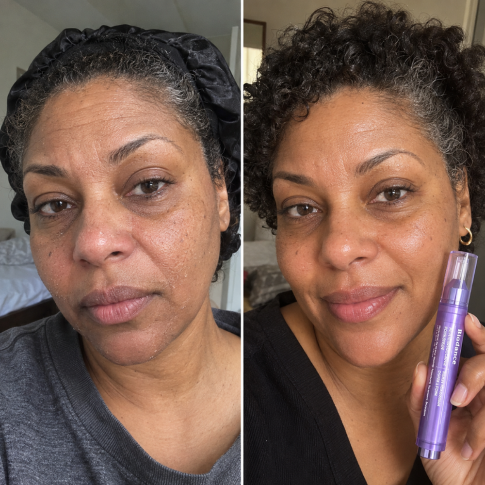 Cheek before and after with Biodance Caviar PDRN Serum