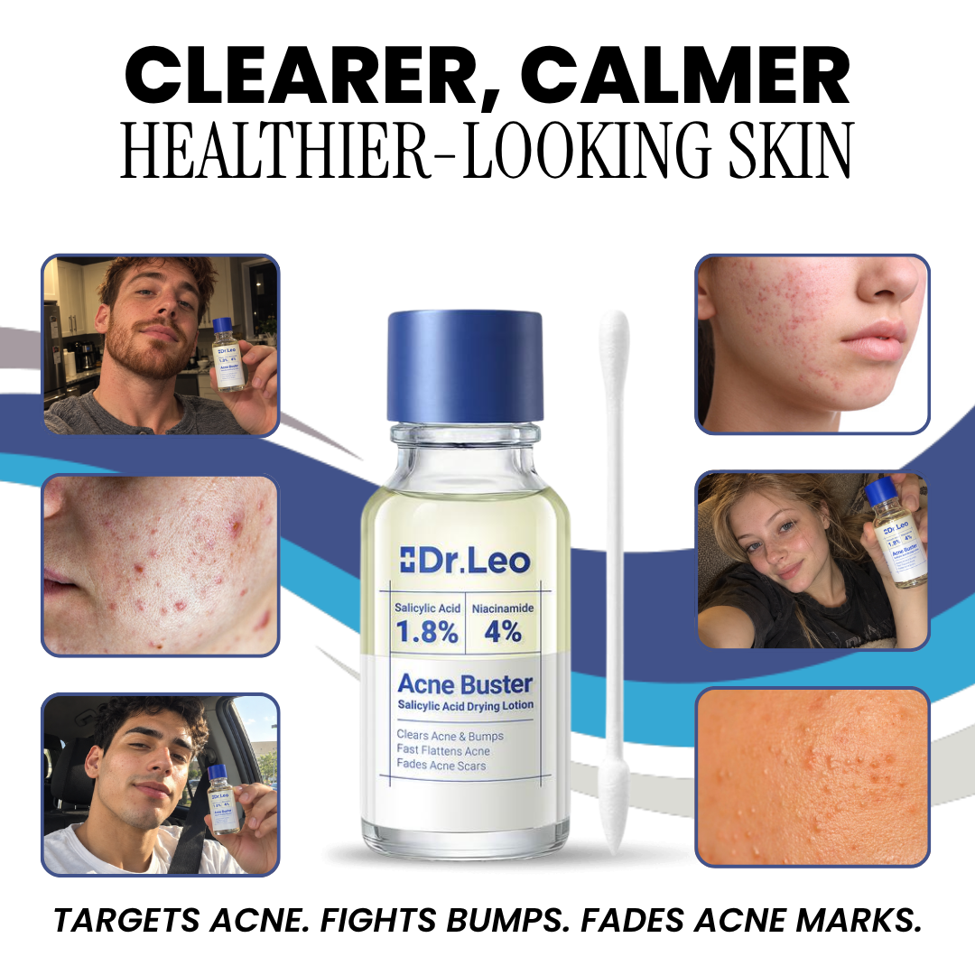 Dr.Leo Acne Buster drying lotion bottle with cotton swab and customer photos