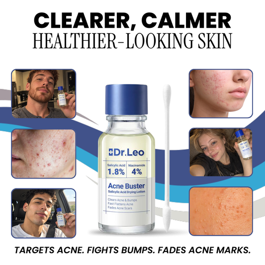 Dr.Leo Acne Buster drying lotion bottle with cotton swab and customer photos