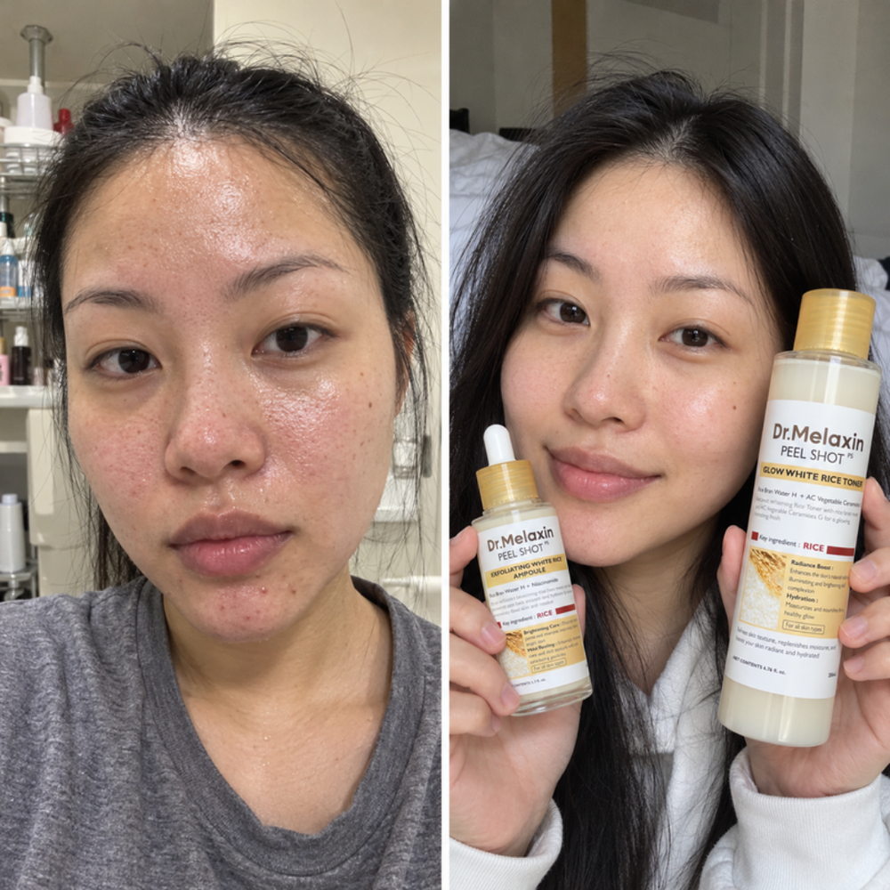 Dr.Melaxin Peel Shot rice peeling gel, look of skin before and after one use