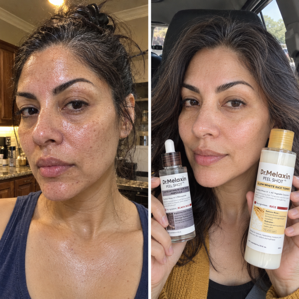 Dr.Melaxin Peel Shot rice peeling gel, look of skin before and after one use