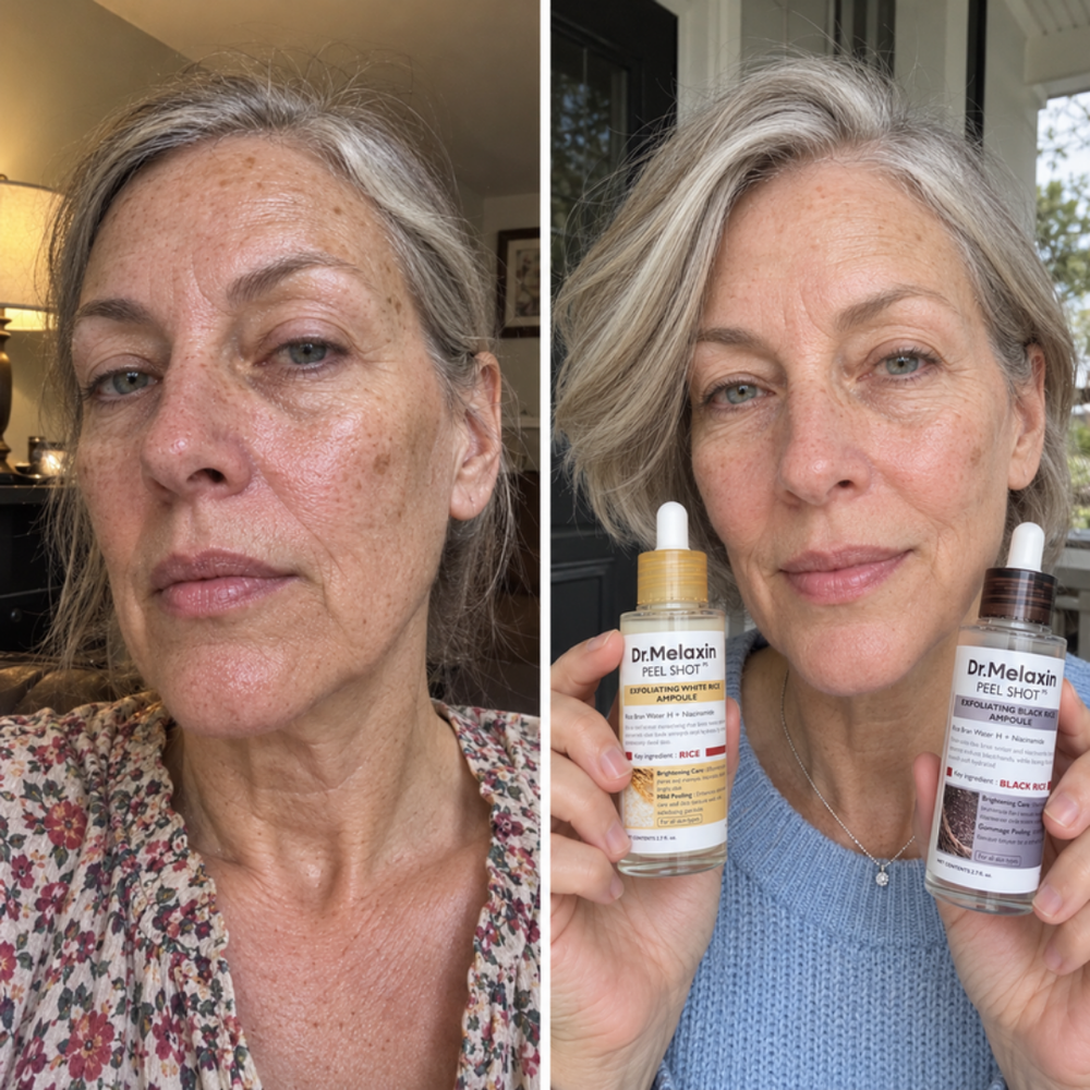 Dr.Melaxin Peel Shot rice peeling gel, look of skin before and after one use