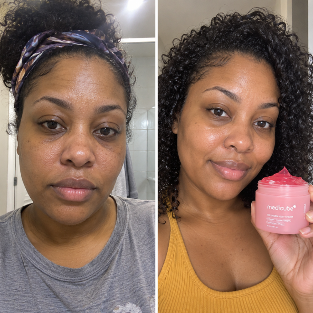 Medicube Collagen Niacinamide Jelly Cream, bare skin and dewy finish after one use