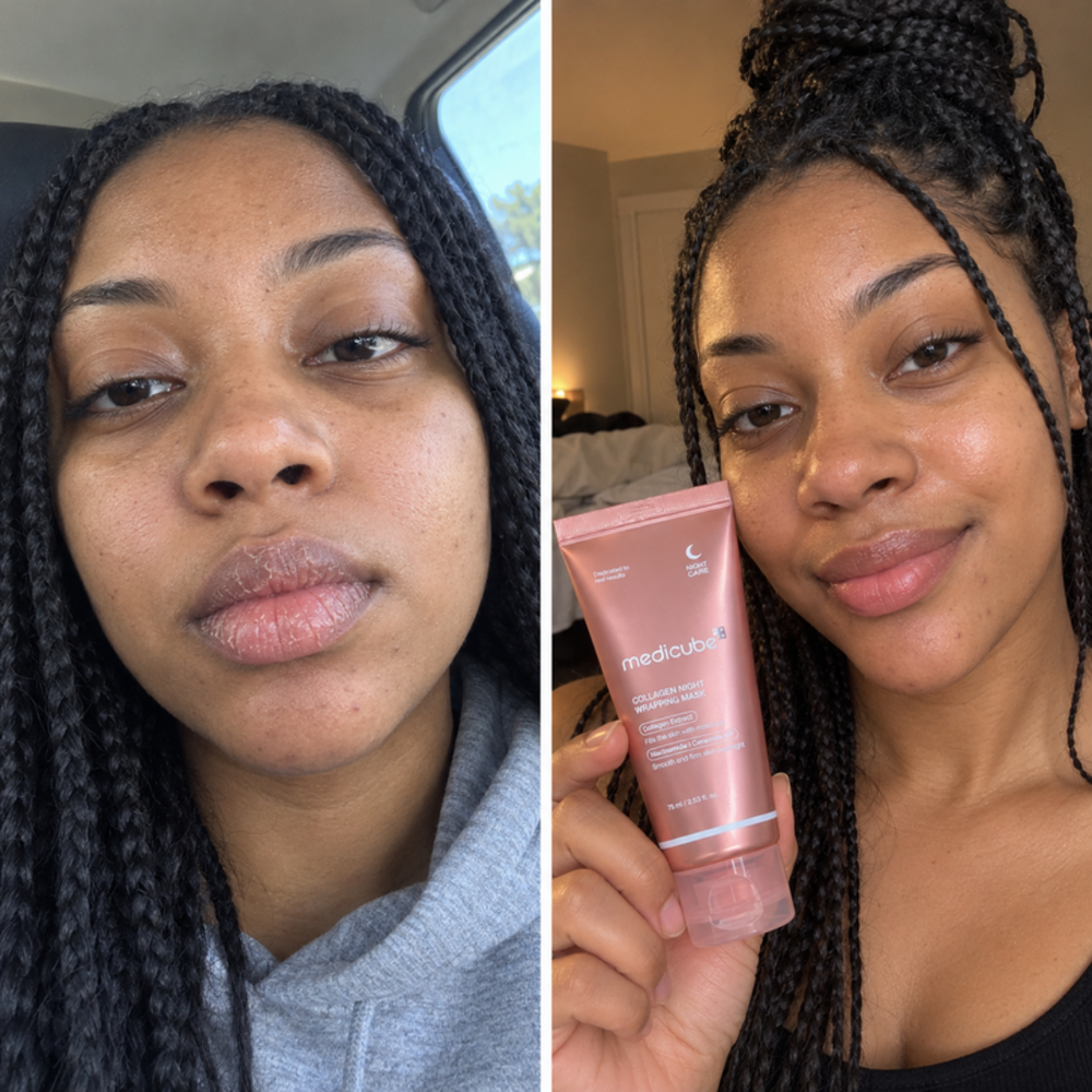 Medicube collagen night wrapping mask, look of skin at bedtime and next morning