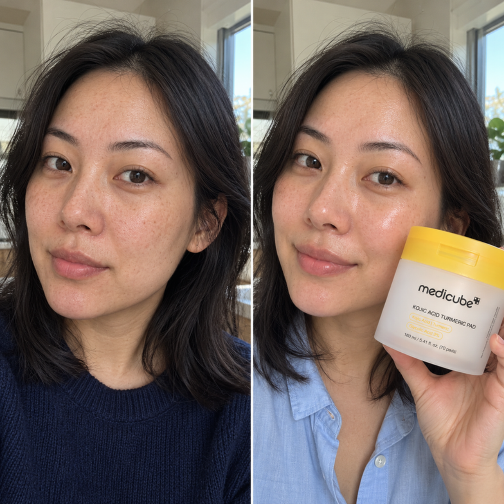 Medicube kojic acid turmeric niacinamide serum, skin before and after three steps