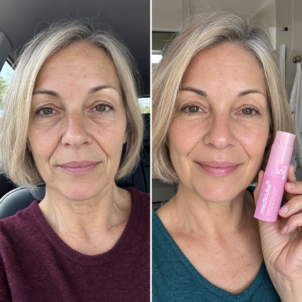 Medicube PDRN balm stick, look of smile lines before and after one use