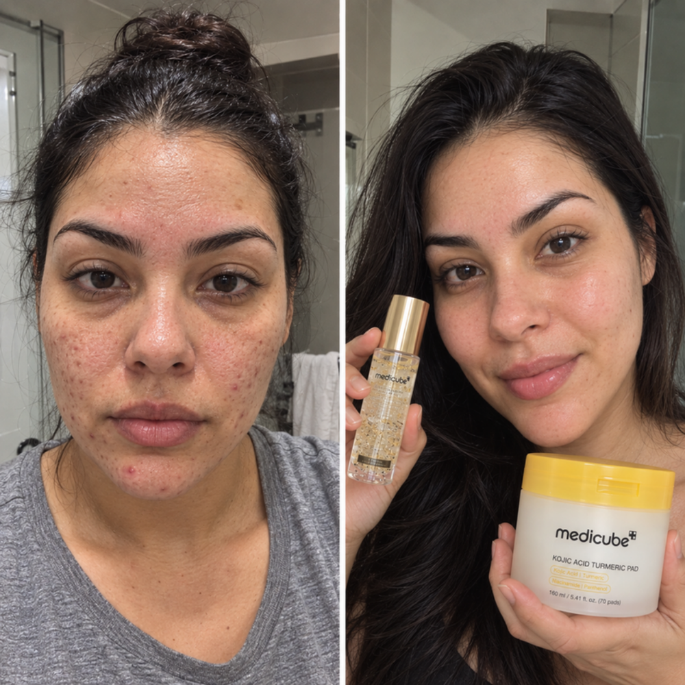 rollerball toner on the look of underarms and knees
