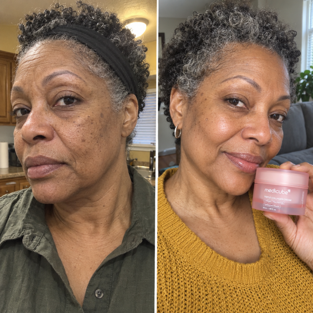 Medicube Triple Collagen Cream, look of hydrated skin before and after one use