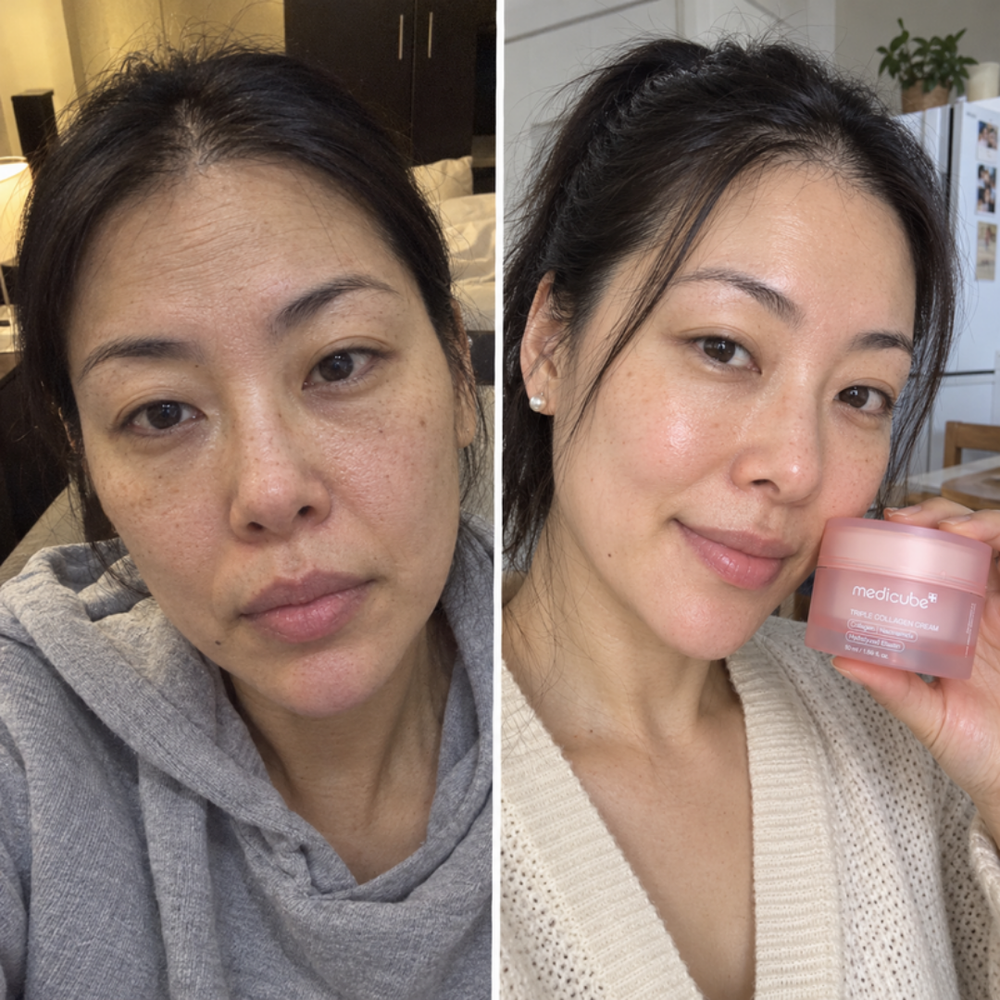 Medicube Triple Collagen Cream, look of skin softness before and after one use