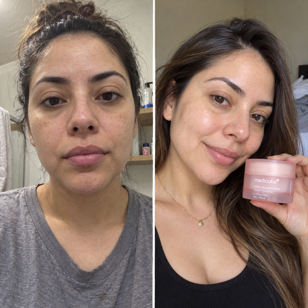 Medicube Triple Collagen Cream, skin glow before and after one use