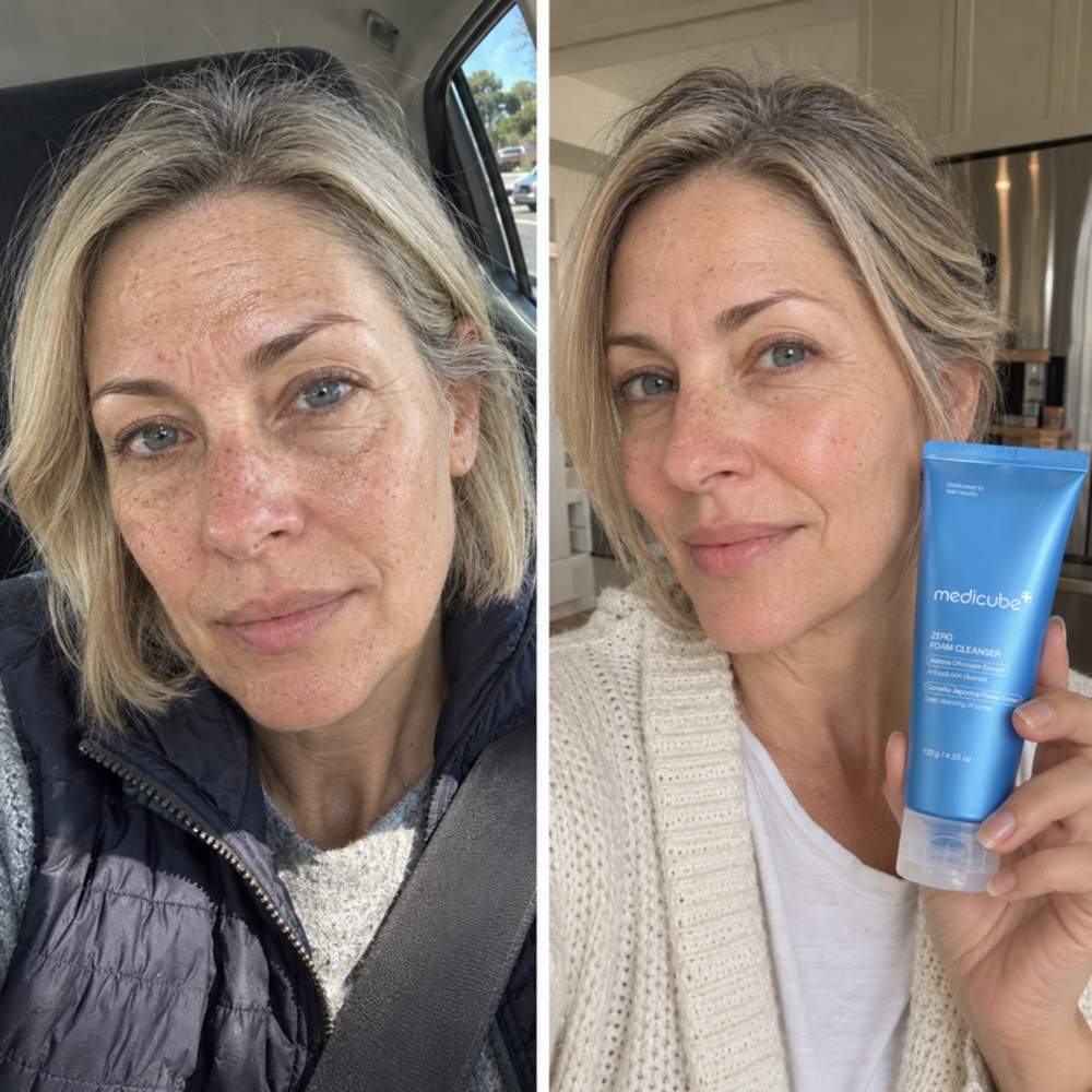 Medicube Zero Foam Cleanser, look of oily skin before and after one wash