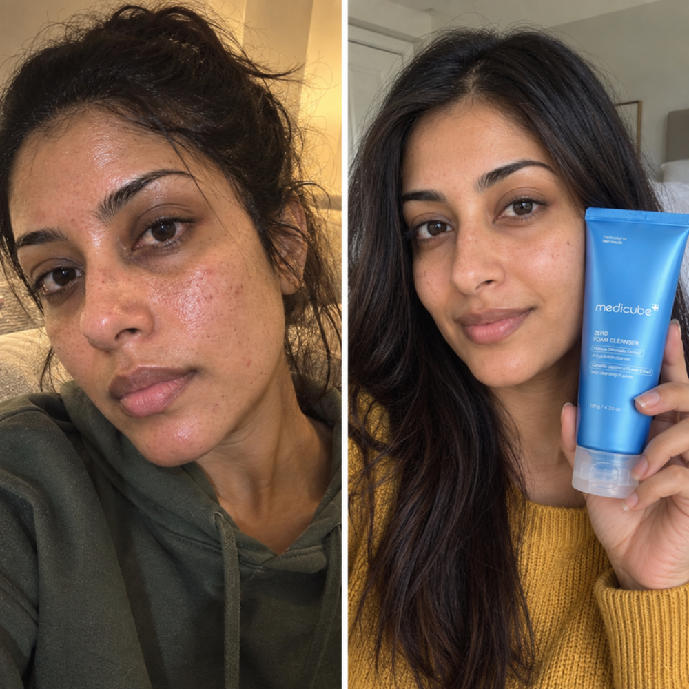 Medicube Zero Foam Cleanser, look of oily skin before and after one wash
