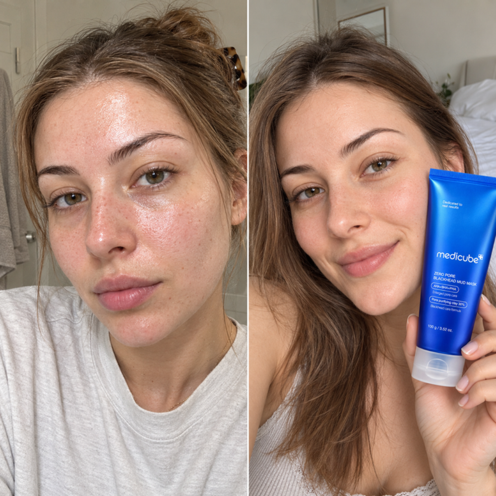 Medicube Zero Pore Mud Mask, look of shine on the nose before and after one use