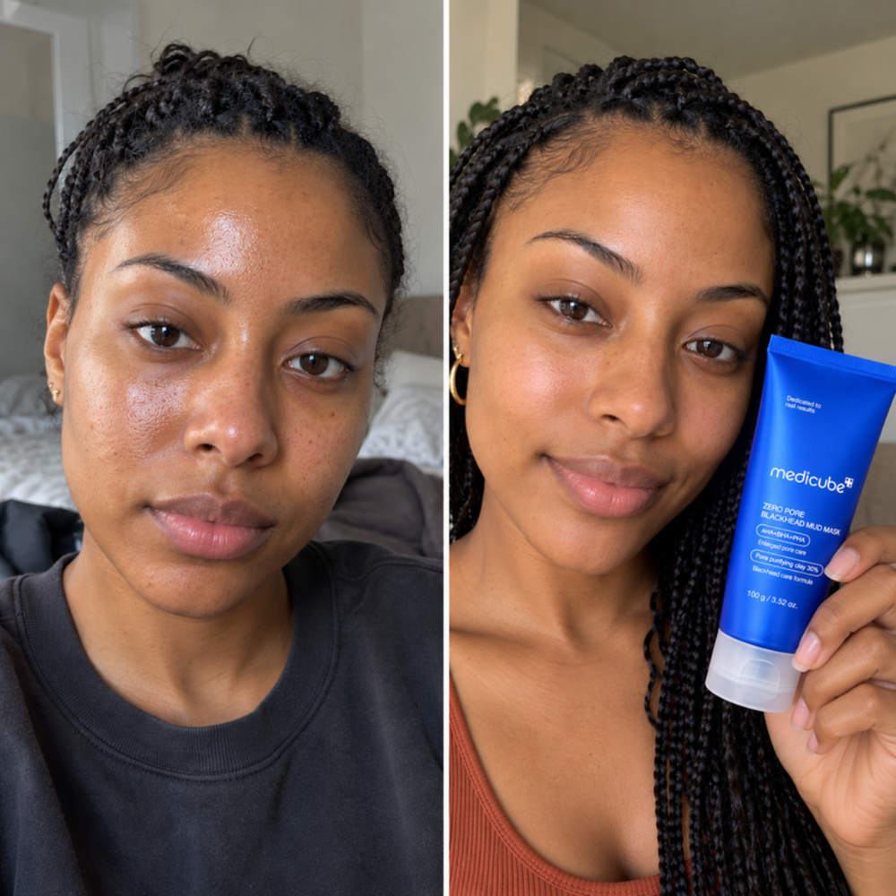 Medicube Zero Pore Mud Mask, look of pores on the forehead before and after one use