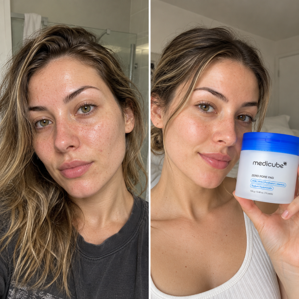 Medicube Zero Pore Pad 2.0, look of skin texture before and after one pad
