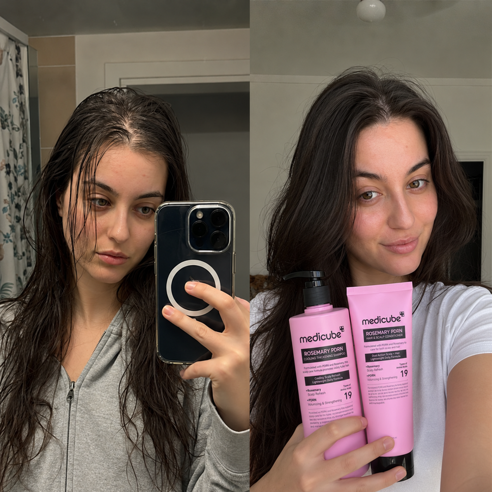 Before / after image