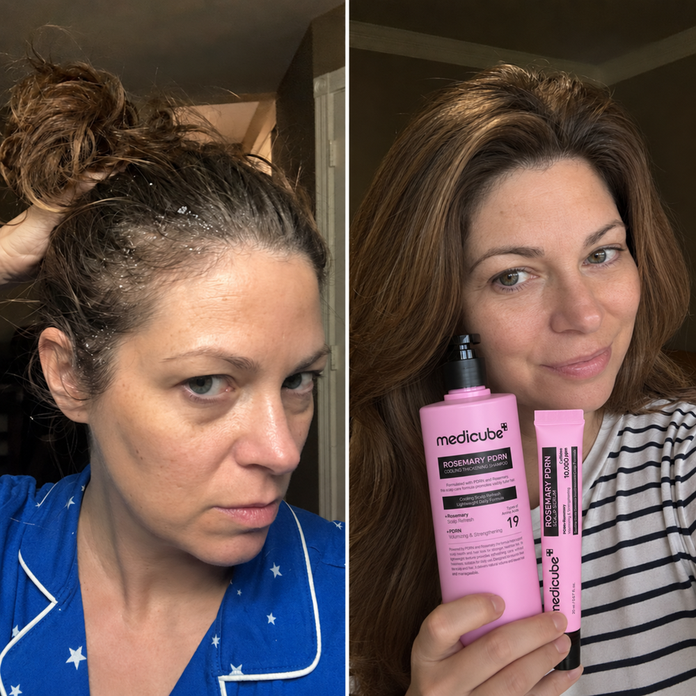Before / after image